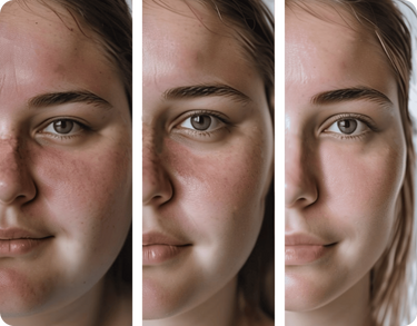 face change